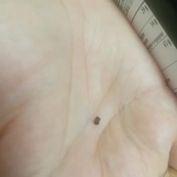 Master Potato Cipsinde Yabancı Parçacık Tespit Edildi Ve Geri Ödeme Talep Ediliyor