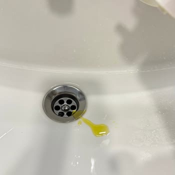 Sebirox Şampuanın Bozulmuş Olması Nedeniyle Ürün Değişimi Ve İade Talebi
