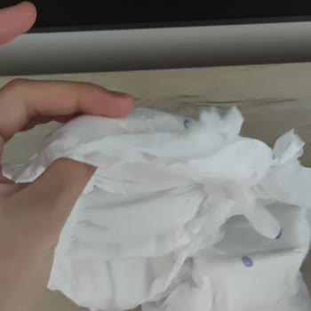 Air Baby Bebek Bezinde Üretim Hatası Ve Hasarlı Paket: Ücret İadesi Ve Değişim Talebi