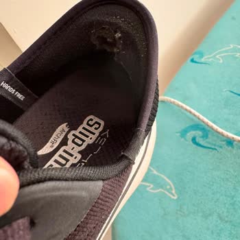 Skechers Arch Fit Ayakkabısının Garanti Sürecinde Deformasyon Ve Reddedilen İade Talebi
