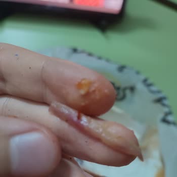 Maydonoz Döner Siparişindeki Çiğ Tavuk Ve Patlamış İçecek Nedeniyle İade Talebi Reddedildi