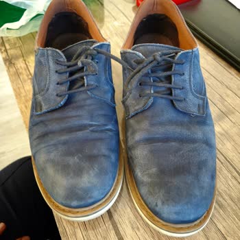 Deichmann Mağazasında Claudio Conti Ayakkabısının Kısa Sürede Deforme Olması Ve İade Talebi