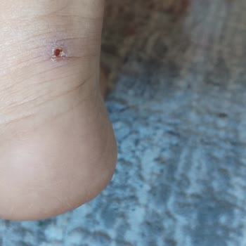 FLO Mağazasındaki U. S. Polo Assn. Ayakkabının İki Saatte Parçalanması Ve İade Talebi