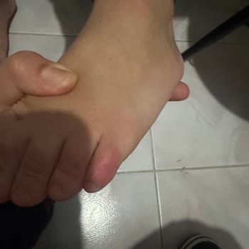 Cevahir AVM Çocuk Ayakkabısının Yarattığı Ağrı Ve İade Talebi