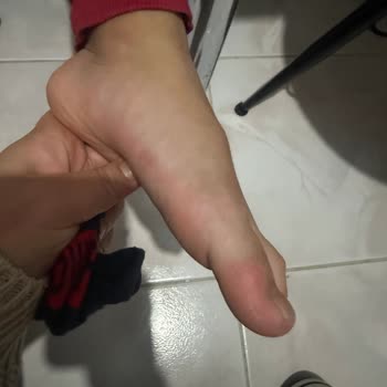 Cevahir AVM Çocuk Ayakkabısının Yarattığı Ağrı Ve İade Talebi