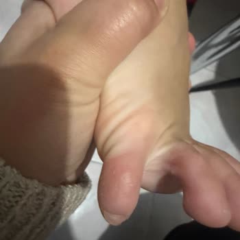 Cevahir AVM Çocuk Ayakkabısının Yarattığı Ağrı Ve İade Talebi