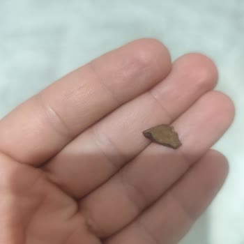 Fıstıklı Baklava İstedi, Cevizli Kadayıf Verildi, Sert Ceviz Kabuğu Dişimi Kırdı