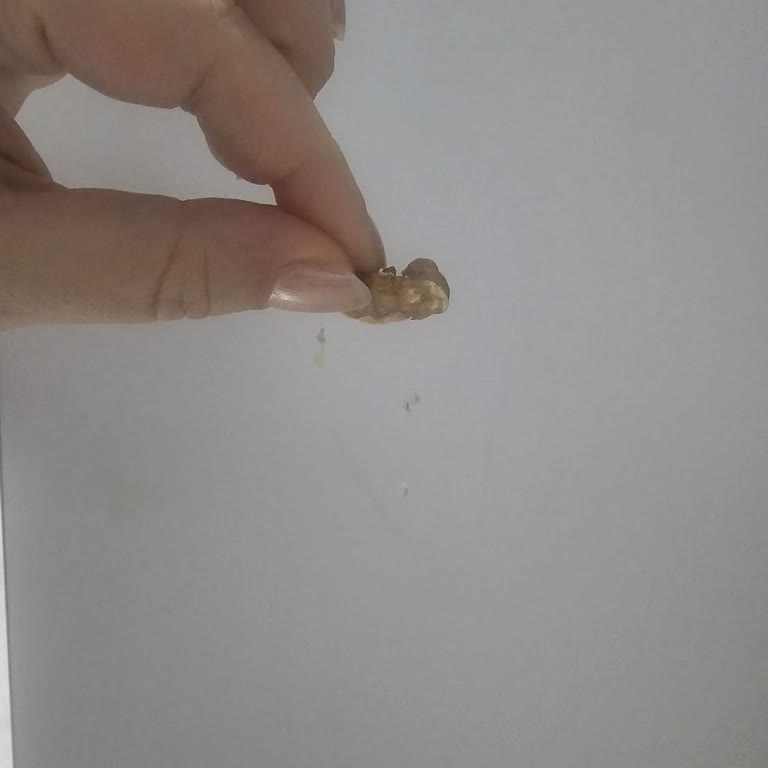 Kış Paketi Cevizlerde Böcek Ağı Görüntüsü Ve İade Süreci Çözülmedi