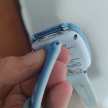 Garanti Kapsamındaki Akıllı Saat Kordonu Koptu, Servis Kullanıcı Hatası Diyor Ve Ücret İstiyor