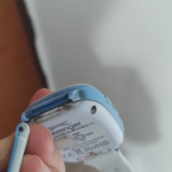 Garanti Kapsamındaki Akıllı Saat Kordonu Koptu, Servis Kullanıcı Hatası Diyor Ve Ücret İstiyor