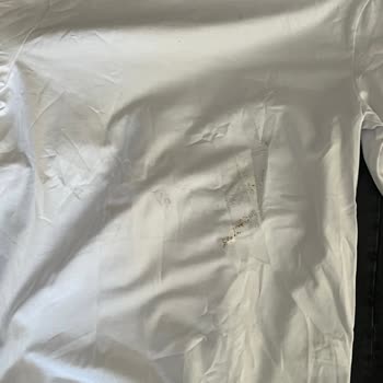 Zara Siparişinde Eksik Ve Lekeli Ürün, Açık Paket Ve Çözüm Yok