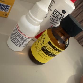 Dalin Bebek Şampuanı Kullanımının Ardından Çocukta Saç Dökülmesi Ve Saçkıran