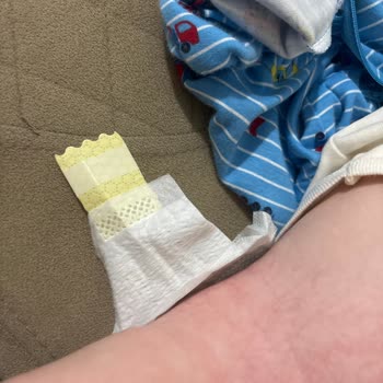 Yeni Formdaki Prima Pampers Bezinde Sertlik Nedeniyle Şiddetli Pişik