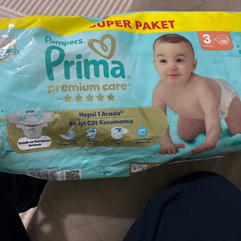 Yeni Formdaki Prima Pampers Bezinde Sertlik Nedeniyle Şiddetli Pişik