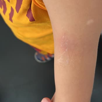 Harikalar Diyarı Anaokulu Çocuk Güvenliği Sorunları Ve İade Reddi