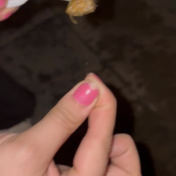 Burcu Konserve Yaprak Sarma İçinde Kıl Çıktı: Hijyen İhlali Ve Mide Bulantısı