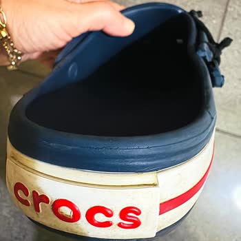 Crocs Türkiye’nin Ücretli Parça Ve Tamir Talebime Umursamaz Yanıtı