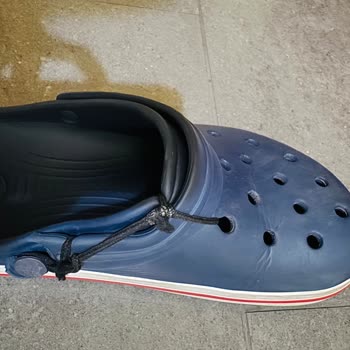 Crocs Türkiye’nin Ücretli Parça Ve Tamir Talebime Umursamaz Yanıtı