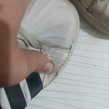 Adidas Ayakkabısında Kısa Sürede Açılma Ve Yırtık: Ayıplı Ürün İadesi Talebi