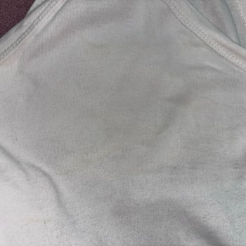 Sleepy Bebek Bezinde Sızdırma Ve Numune Gönderme Talebine Çözüm İstiyorum