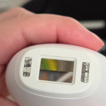 Cihaz Aşırı Isınıyor, Elektrik Kıvılcımı Çıktı Ve Cildi Yakıyor