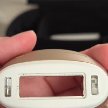 Cihaz Aşırı Isınıyor, Elektrik Kıvılcımı Çıktı Ve Cildi Yakıyor