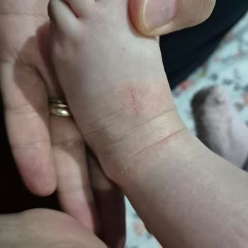 Mustela Stelatopia+ Kremi Bebek Cildinde Kızarıklık Ve Kuruluğu Şiddetle Artırdı
