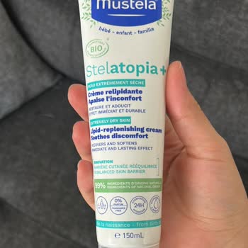 Mustela Stelatopia+ Kremi Bebek Cildinde Kızarıklık Ve Kuruluğu Şiddetle Artırdı