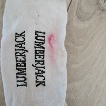 Lumberjack Spor Ayakkabısının Boyası Sızıyor, Çoraplar Kırmızıya Boyanıyor