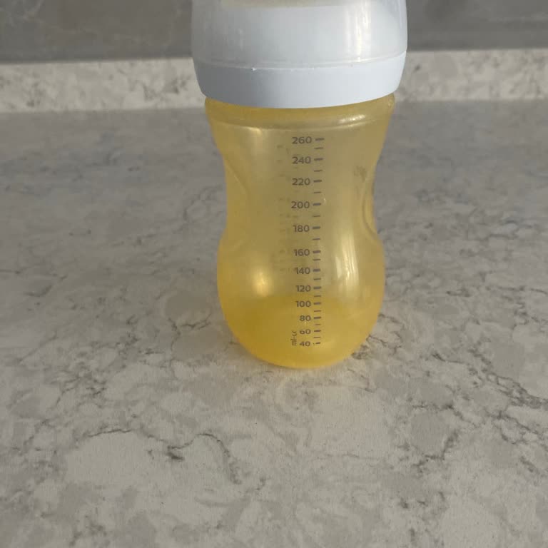 Philips Avent Biberonun Kısa Sürede Sararması Ve Garanti İhmalı