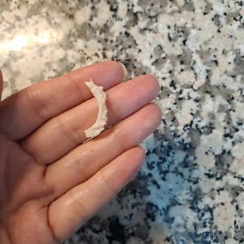 A101’den Bahçıvan Labne’de Küf: Son Kullanma Tarihi Geçmemiş Olmasına Rağmen Sağlık Riski