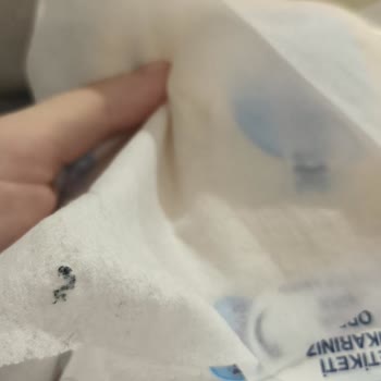 Molfix İzotonik Yenidoğan Islak Mendilinde Yabancı Cisim Bulundu Ve Güvenlik Şikayeti
