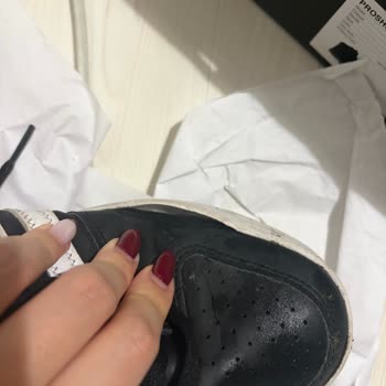 Adidas Spor Ayakkabının Tabanda Çözülmesi Ve Hızlı Değişim Talebi