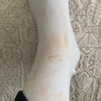 Solante Pigmenta Tinted Lotion Ürünü Çamur Gibi Kalıp Kıyafet Ve Eşyalara Lekeler Bırakıyor