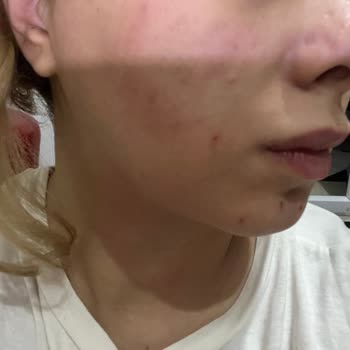 Clove Güzellik Esenyurt Şubesinde Saygısız Davranış Ve Yanıltıcı Ücretlendirme
