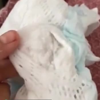 Prima Bebek Bezi Pişik Yaptı Memnun Değilim