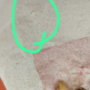 Burger King Şubelerinde Kıkırdak Ve Kemik Parçası Bulunması Nedeniyle Sağlık Riski Ve İade Talebi