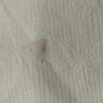Burger King Şubelerinde Kıkırdak Ve Kemik Parçası Bulunması Nedeniyle Sağlık Riski Ve İade Talebi