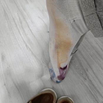Derimod Bej Süet Ayakkabısının Boyasının Çoraplara Akması Ve Ücret İadesi Talebi