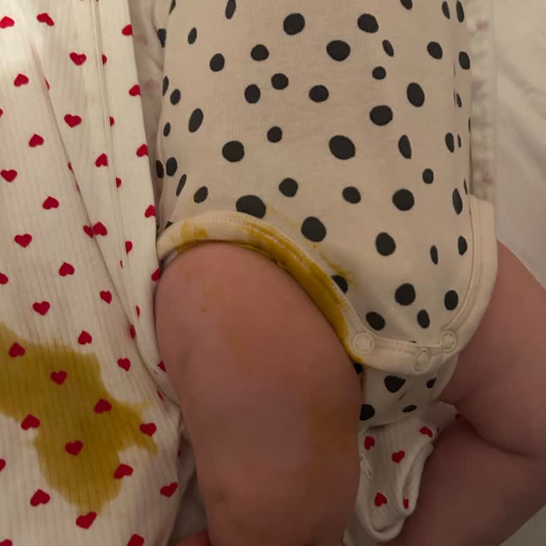 Prima Premium Care 2 Numara Bezlerinde Sürekli Sızdırma Sorunu