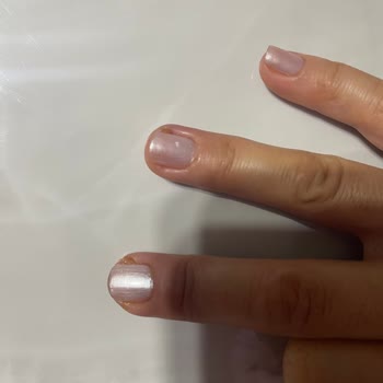 Gratis Beauty Bakırköy’de Dikkatsiz Manikür Sonrası Şiddetli Acı Ve Enfeksiyon