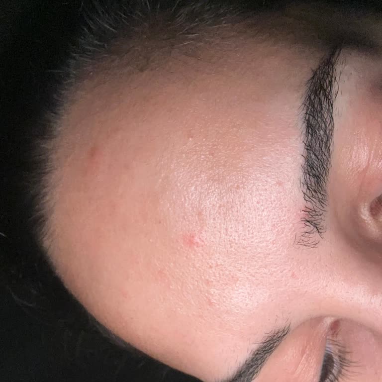 Boyner'den Aldığım Estee Lauder Night Repair Serumu Ciltte Alerjik Reaksiyon Ve İade Talebi