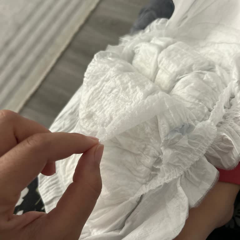 Molfix Bebek Bezinde Üretim Hatası Nedeniyle Sızıntı Ve Sağlık Endişesi