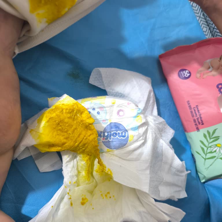 Molfix 2 Numaralı Bebek Bezlerinde Emicilik Yetersizliği Ve Sık Kıyafet Kirlenmesi