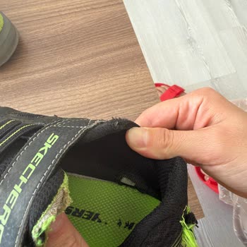 Skechers Çocuk Ayakkabılarında Erken Yırtılma Ve Kullanıcı Hatası Reddi