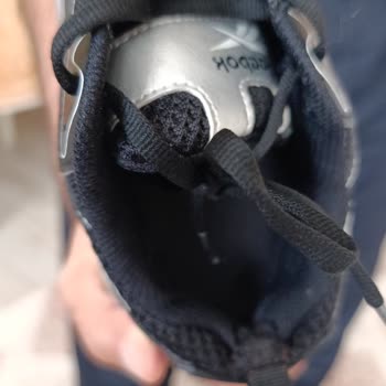 Reebok Grand Cane Kadın Sneaker Ayakkabısının Ayak Yarasına Neden Olması Ve İade Talebi