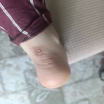 Reebok Grand Cane Kadın Sneaker Ayakkabısının Ayak Yarasına Neden Olması Ve İade Talebi