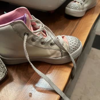 Skechers Ayak Kokusuna Ve Açılmalara Karşı Ayıplı Ürün Şikayeti Ve İade Talebi