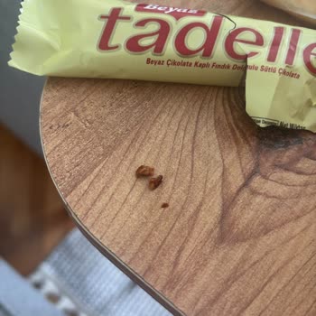 Grosper Tadelle Çikolatasında Sert Fındık Parçaları Nedeniyle Diş Ağrısı Ve Gıda Güvenliği Şikayeti
