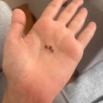 Grosper Tadelle Çikolatasında Sert Fındık Parçaları Nedeniyle Diş Ağrısı Ve Gıda Güvenliği Şikayeti